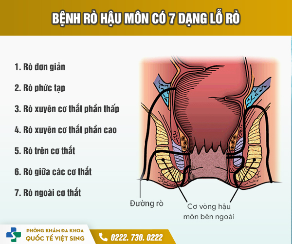 https://www.benhtribacninh.vn/wp-content/uploads/2023/05/cac-loai-ro-hau-mon.jpg