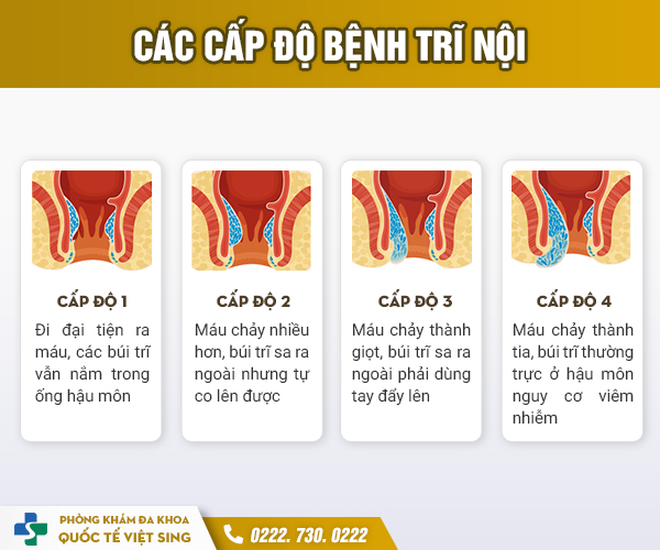 https://www.benhtribacninh.vn/wp-content/uploads/2023/05/cap-do-benh-tri-noi.jpg