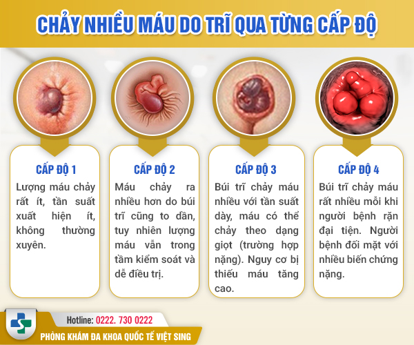 https://www.benhtribacninh.vn/wp-content/uploads/2023/05/chay-mau-tri-qua-cap-do.jpg