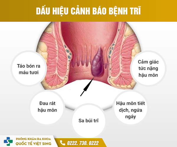 https://www.benhtribacninh.vn/wp-content/uploads/2023/05/dauhieutri.jpg