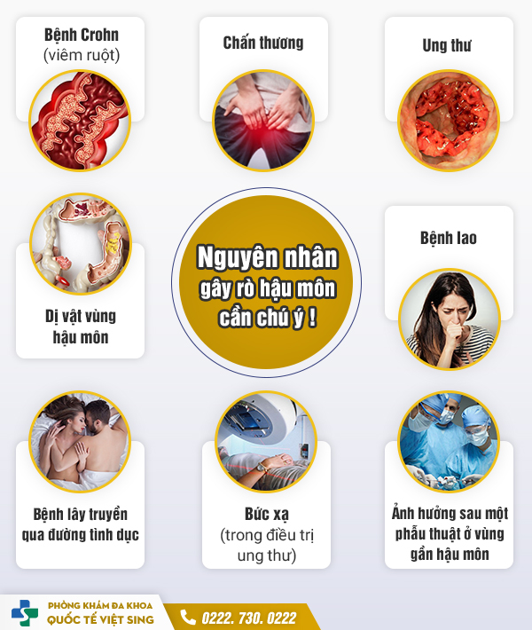 https://www.benhtribacninh.vn/wp-content/uploads/2023/05/nguyen-nhan-bi-ro-hau-mon.jpg