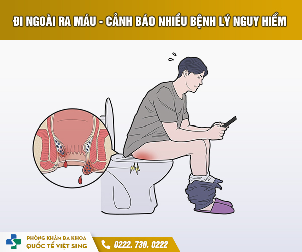 https://www.benhtribacninh.vn/wp-content/uploads/2023/06/Tri-1.jpg