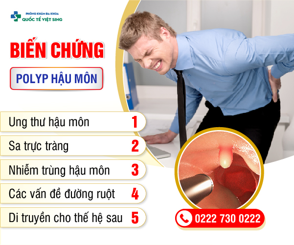 https://www.benhtribacninh.vn/wp-content/uploads/2023/06/bienchungpolyp-1.jpg