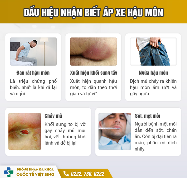 https://www.benhtribacninh.vn/wp-content/uploads/2023/06/dau-hieu-nhan-biet-ap-xe-hau-mon.jpg