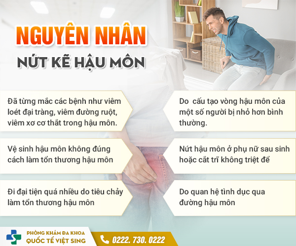 https://www.benhtribacninh.vn/wp-content/uploads/2023/06/nguyen-nhan-nut-ke-hau-mon.jpg