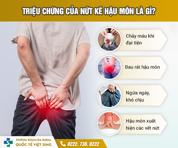 https://www.benhtribacninh.vn/wp-content/uploads/2023/06/trieu-chung-nut-ke-hau-mon-1.jpg