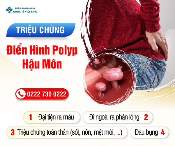 https://www.benhtribacninh.vn/wp-content/uploads/2023/06/trieuchungpolyp.jpg