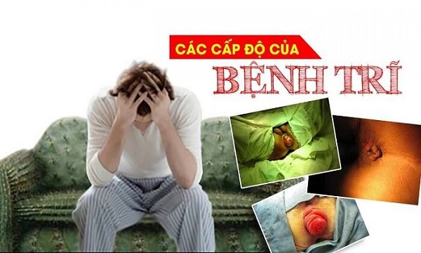https://www.benhtribacninh.vn/wp-content/uploads/2025/08/cac-cap-do-cua-benh-tri.jpg
