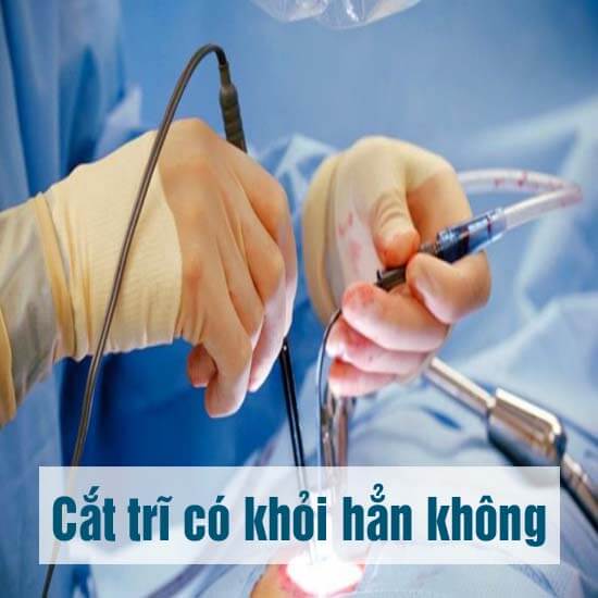 https://www.benhtribacninh.vn/wp-content/uploads/2025/08/cat-tri-co-khoi-han-khong-sau-cat-tri-co-tai-phat-khong.jpg